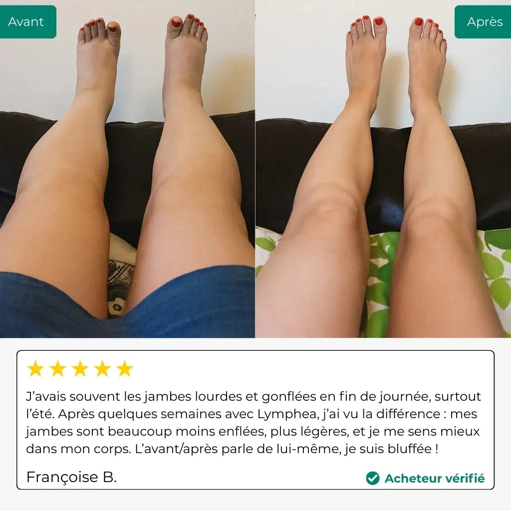 Crème Anti Points Noirs Dreyora®