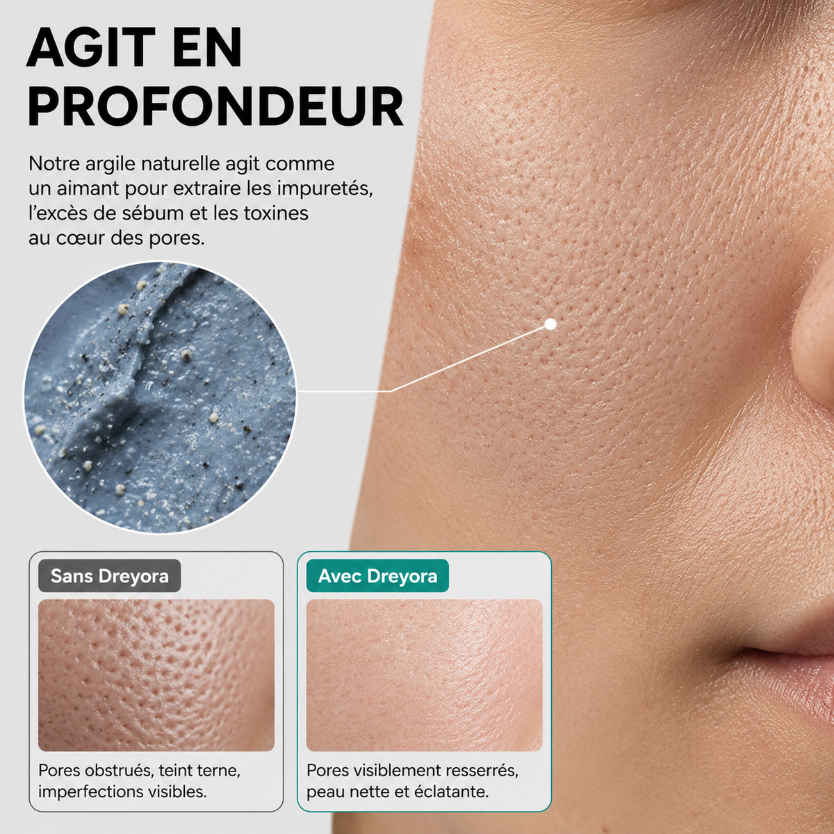 Crème anti point noir Dreyora